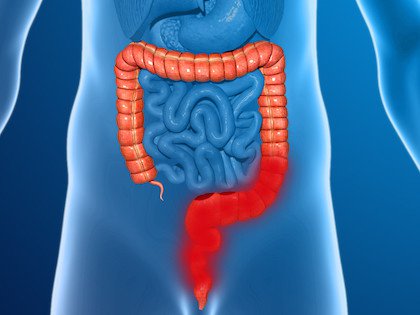 Nutrición en Colitis